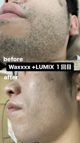 メンズ Epina 千葉店 【エピナ】のエステ・リラクイメージ