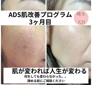 private salon  Dea_maris シュガーリング＆パーソナルボディケア所属・シミ改善・韓国肌管理 ボディメイク痩身のその他イメージ