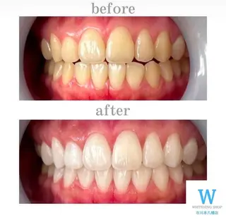 ホワイトニング ショップ本八幡店のエステ・リラクイメージ