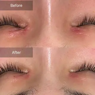 Mandarin Orange所属・毛穴から始める肌メン テマンダリンオレンジのエステ・リラクイメージ