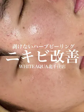 WHITE AQUA 北千住店のエステ・リラクイメージ