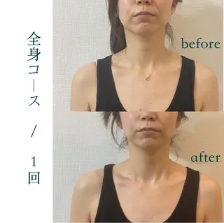 小顔&美容矯正 サロン🌿Miloのエステ・リラクイメージ