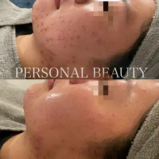 PERSONAL BEAUTY🪻のエステ・リラクイメージ