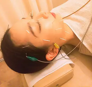 むくみたるみ専門☆ 美容鍼・小顔矯正のエステ・リラクイメージ