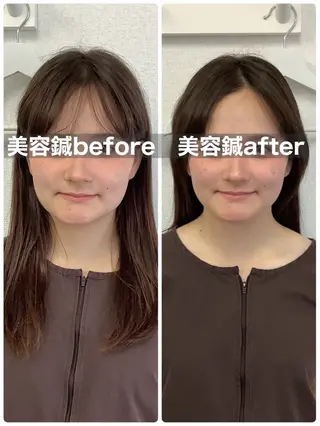 hari salon de off 美容鍼灸×小顔整体【ハリサロンドオフ】所属・美容鍼×小顔整体🤍 ishibashiのエステ・リラクイメージ