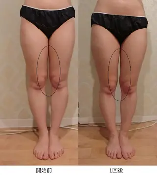 くびれ作り専門サロン こねこのシッポ虎ノ門のエステ・リラクイメージ