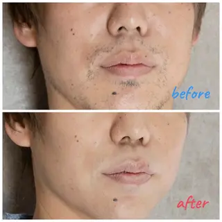 メンズ A.D LABO所属・A.D LABO yu-kaのエステ・リラクイメージ