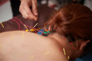 美楽鍼 美容鍼のエステ・リラクイメージ