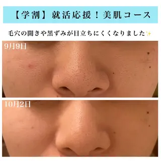 Bellesthe (ベルエステ)のエステ・リラクイメージ