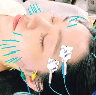 小顔美容鍼専門サロン 渋谷YZのエステ・リラクイメージ