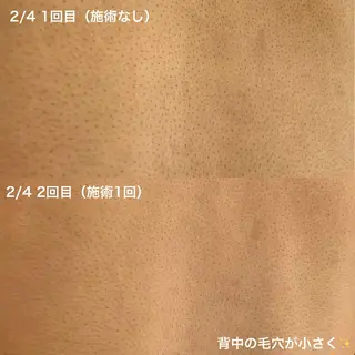 美肌コラーゲン脱毛SINCERITE【サンセリテ】所属・瀬野 のぞみのエステ・リラクイメージ