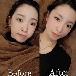 メンズ 美容鍼灸サロン LOMIHARIのエステ・リラクイメージ