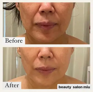 糸島 エステサロンmiuのエステ・リラクイメージ