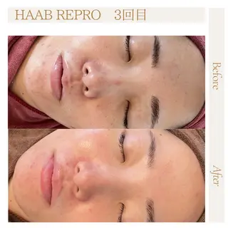 肌管理サロン neoriiのその他イメージ