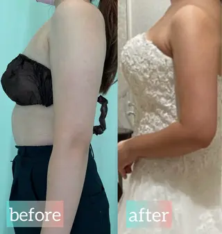 UNA SHIROKANE所属・脂肪冷却サロンUNA SHIROKANEのその他イメージ