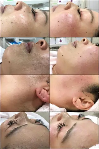 フェイシャル/脱毛 ジョアアンジェ　田中のエステ・リラクイメージ