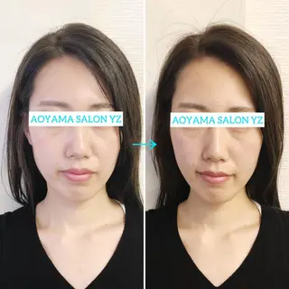 小顔美容鍼専門サロン 渋谷YZのエステ・リラクイメージ