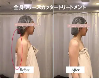 痩身×フェイシャル ブライダル|Linoのエステ・リラクイメージ