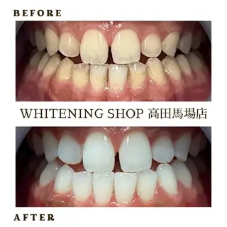 メンズ ホワイトニング ショップ高田馬場店のその他イメージ