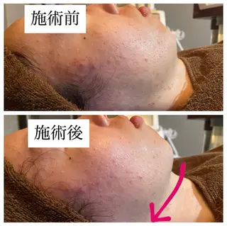 肌質改善専門 ハーブ /毛穴洗浄 リエイトのエステ・リラクイメージ