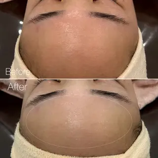 〈etre〉トータルビューティーサロン所属・etre - 韓国肌管理 -のエステ・リラクイメージ