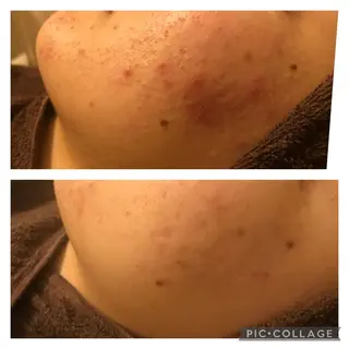 ミディアム カラー パーマ ヘアアレンジ メンズ キッズ マツエク・マツパ アニメ,Vオタク× 即効痩せエステサロンのエステ・リラクイメージ