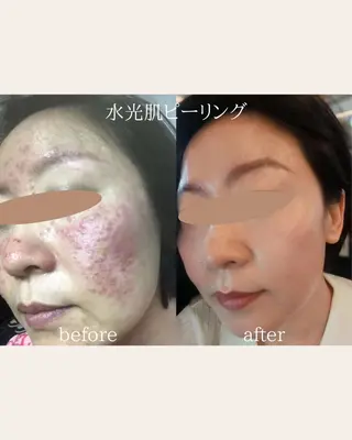 痩身/腸もみ/ ヘッドスパ/リンパのエステ・リラクイメージ