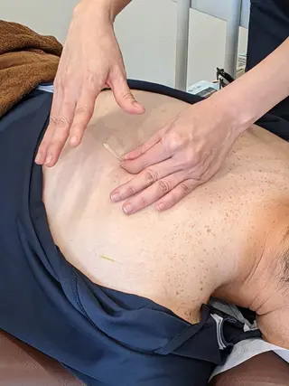 天久ゆがみ整骨院所属・天久ゆがみ 鍼灸整骨院のエステ・リラクイメージ