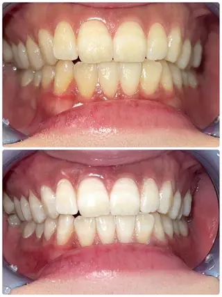 セルフホワイトニング エクシア徳島店のその他イメージ