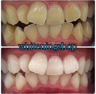 ホワイトニングショップ伊丹店所属・ホワイトニング ショップ伊丹店のその他イメージ