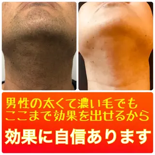 ニキビ・ 肌荒れ専門店のエステ・リラクイメージ