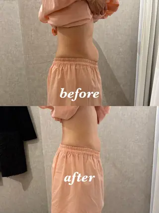 メンズ 腸活サポート みなみののエステ・リラクイメージ