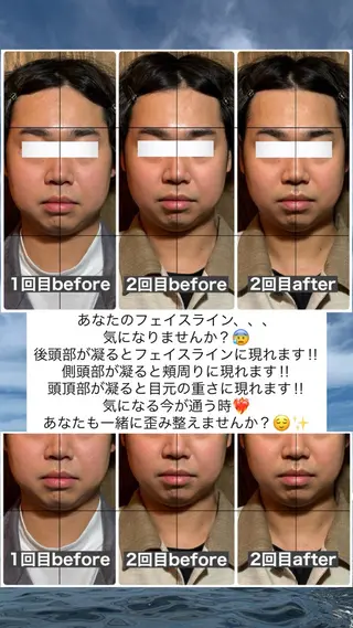 💎後悔させない小顔 矯正💎イトヤマ🌱のエステ・リラクイメージ