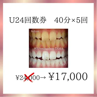 メンズ キッズ ホワイトニング ショップ多摩店のその他イメージ