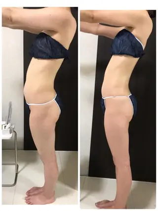 ダイエット／脱毛 美顔／フォト／ハーブのその他イメージ