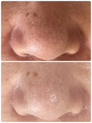 De I'm トータルビューティーサロン所属・COCO beautyサロンのエステ・リラクイメージ