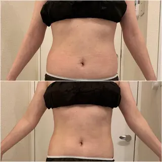 ✨美肌水光✨ アトリエリュバンのエステ・リラクイメージ