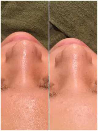 【リベルハーブピーリング認定店】敏感肌・美白脱毛専門店Dione立川店所属・Dione 立川店のエステ・リラクイメージ