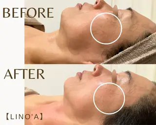 Salon💫 Lino'a柏店のエステ・リラクイメージ