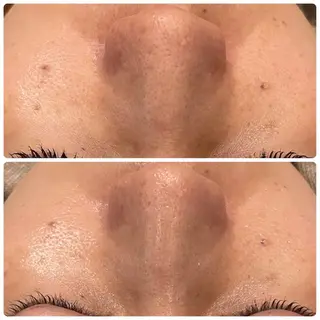 yellow.所属・yellow💛【 脱毛&フェイシャル】のエステ・リラクイメージ