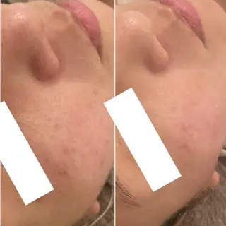 ✨美肌水光✨ アトリエリュバンのエステ・リラクイメージ