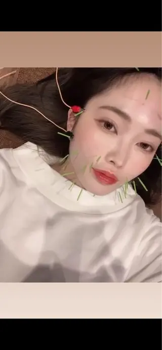 メンズ 美容鍼灸サロン LOMIHARIのエステ・リラクイメージ