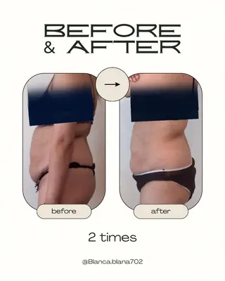 プライベートエステサロンBlanca所属・Blanca ナミキのエステ・リラクイメージ