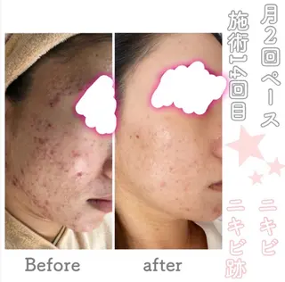 都度払い肌改善専門店 店長二上文香のエステ・リラクイメージ