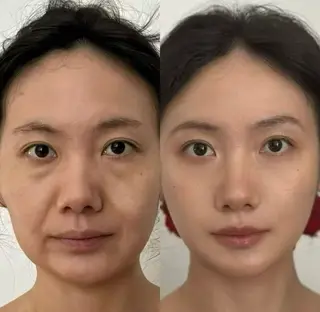 マツエク・マツパ aliaハイフ&水光ジェットサロン所属・aliaハーブ水光店 エステティシャン募集のエステ・リラクイメージ