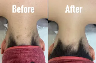 バストケア RAYVIS梅田店Nのエステ・リラクイメージ