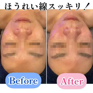 TEIKOKU所属・トータルビューティー TEIKOKUのエステ・リラクイメージ