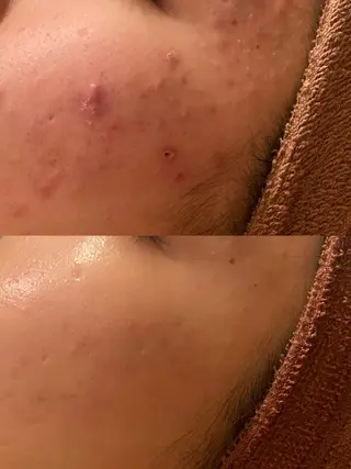 触れたくなる モテ肌へ...❤︎のエステ・リラクイメージ