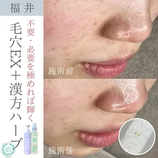 毛穴ケア専門サロン Yourmeユアミーのエステ・リラクイメージ