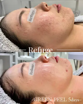 グリーンピール専門サロン Refuge.所属・Refuge. (リフュージュ)のエステ・リラクイメージ